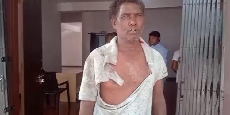 सीसीएल के इलेक्ट्रीशियन हेल्पर को दो युवकों ने जमकर पीटा