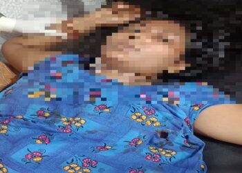 गोमिया में खौफनाक वारदात, घर में घुसकर युवक ने महिला को चाकू से गोद डाला