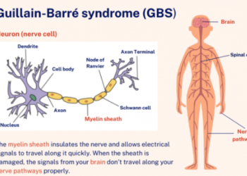 झारखंड में गुइलेन-बैरे सिंड्रोम का एक और संदिग्ध मामला: 7 साल की बच्ची की हालत गंभीर